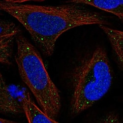KCTD8 Antibody, Novus Biologicals 25 &mu;L; Unlabeled:Antibodies, Polyclonal